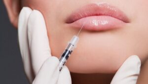 Preenchimento-Labial