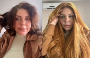Simony - Antes e Depois